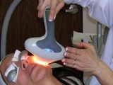 Depilacin definitiva de rostro