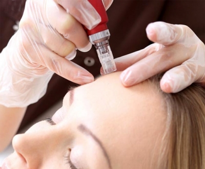 Aplicaciones y beneficios de la mesoterapia con peptonas